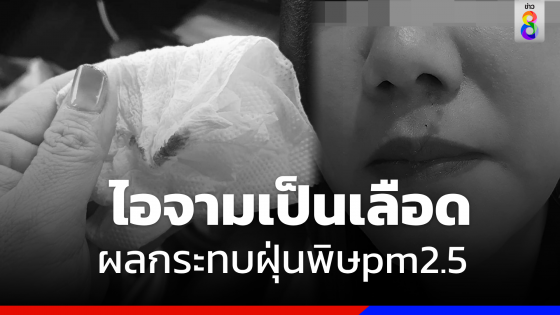 พิษ pm2.5 ! "ชาวเชียงใหม่" กระทบหนัก ไอจามเป็นเลือด