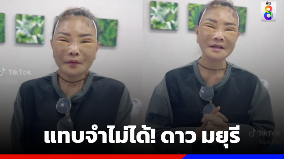 "ดาว มยุรี" เผยหน้าสดหลังผ่าตัด