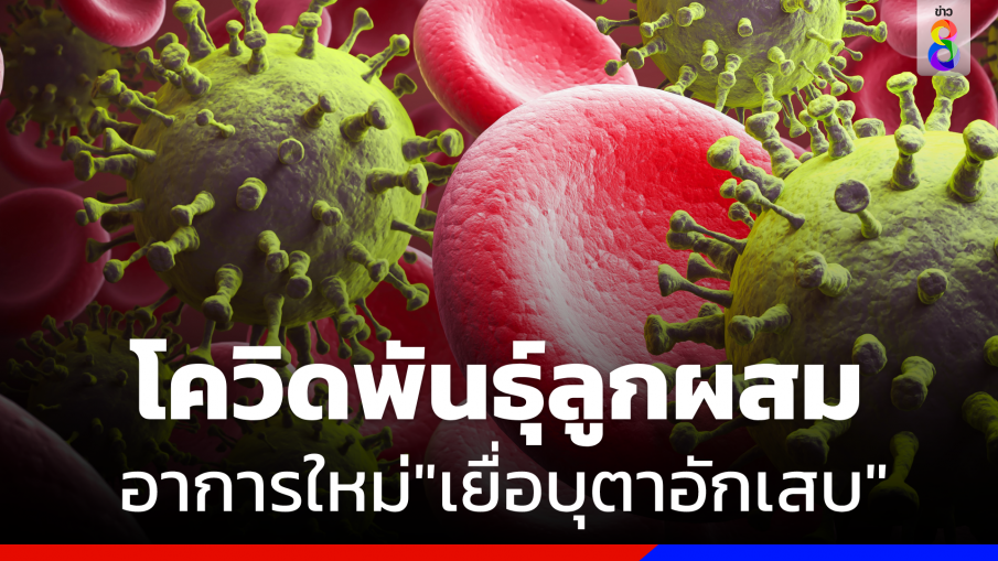 รู้จักโควิดสายพันธุ์ใหม่ "โอมิครอน XBB.1.16"อาการเด่นเยื่อบุตาอักเสบ