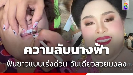 เปิดความลับ ธิดาช้าง ฟันสวยแบบสับๆ งานนี้วงการทันตแพทย์สะเทือน