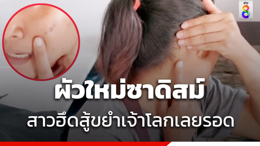 สาวสุดทนร้องเอาผิดผัวใหม่เมาแล้วซาดิสม์ กัดคอ กดหัวลงคอห่าน