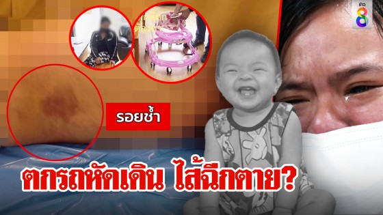 ตกรถหัดเดิน ไส้ฉีกตาย?