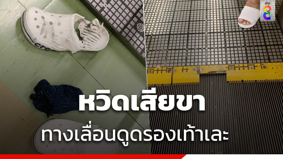 ผู้โดยสารเล่าย้อนหวิดเสียขาที่สนามบินดอนเมืองเมื่อปี 62