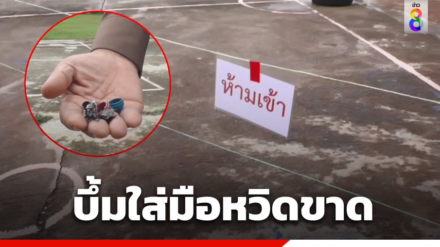 ม.2 เจอระเบิดในโรงเรียน เก็บมาจะเอาไปให้ผู้ใหญ่ พลาดบึ้มใส่มือหวิดขาด