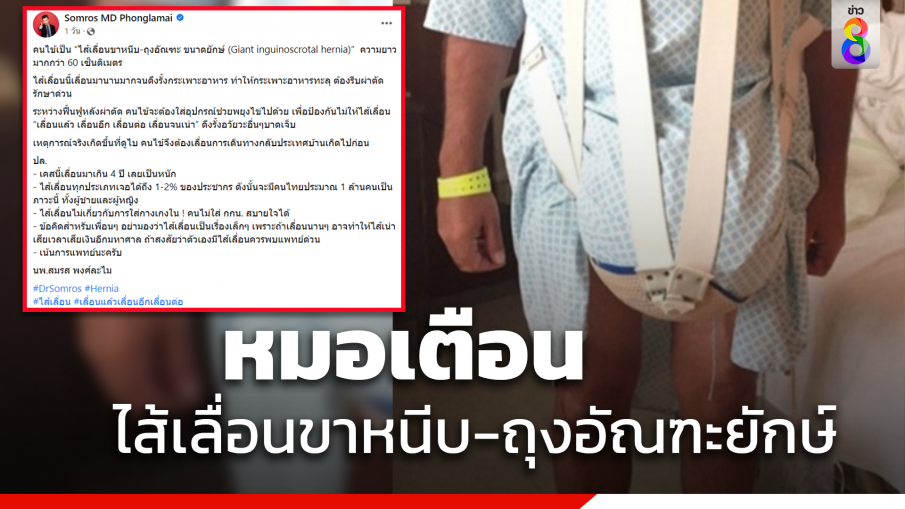 หมอเตือนระวัง ไส้เลื่อนขาหนีบ-ถุงอัณฑะ อันตรายควรพบแพทย์