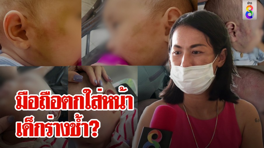 แม่ช็อกฝากเลี้ยงลูกหน้าช้ำ พี่เลี้ยงอ้างมือถือตกใส่ เหยื่อใหม่โผล่แฉวีรกรรมสุดโต่ง