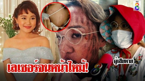 สาวทำเลเซอร์หน้าไหม้ พนักงานมือใหม่ขอโทษทำหน้าพัง อึ้งค่ารักษาเกือบครึ่งแสน
