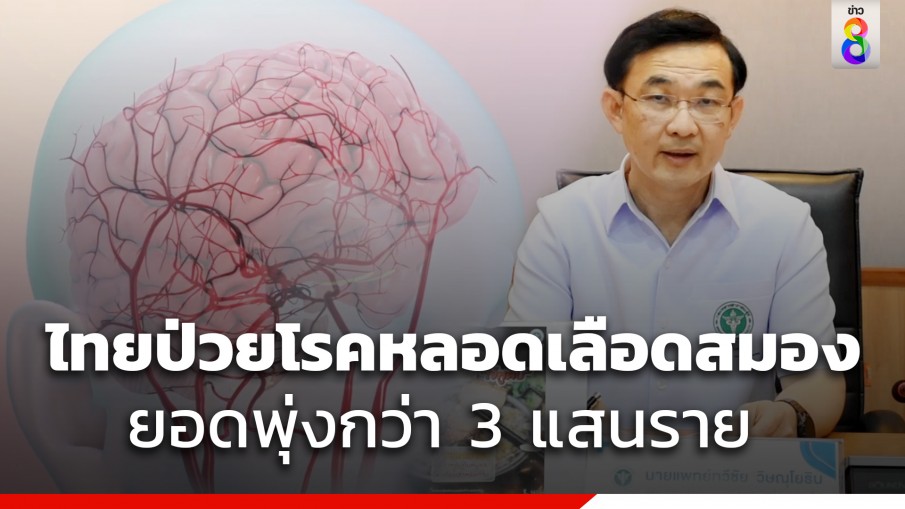 ควบคุมโรค เร่งป้องกันโรคหลอดเลือดสมอง หลังพบไทยป่วยพุ่ง 3 แสนราย โคราชมากสุด