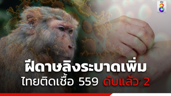 เตือน ! ฝีดาษลิงระบาดเพิ่ม ทั่วประเทศติดเชื้อแล้ว 559 เสียชีวิตแล้ว 2 ราย