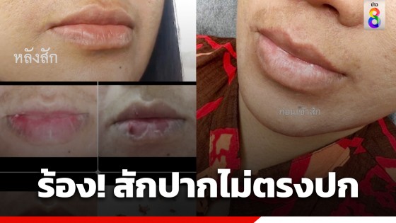 หญิงวัย 47 ปี ร้อง! สักปากสีชมพู แต่ผลลัพธ์กลับไม่ตรงปก ทางร้านปัดความรับผิดชอบ