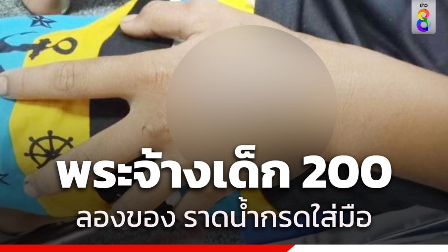 พิสูจน์หนังเหนียว! พระจ้างเด็ก 200 ลองของ ราดน้ำกรดใส่มือ