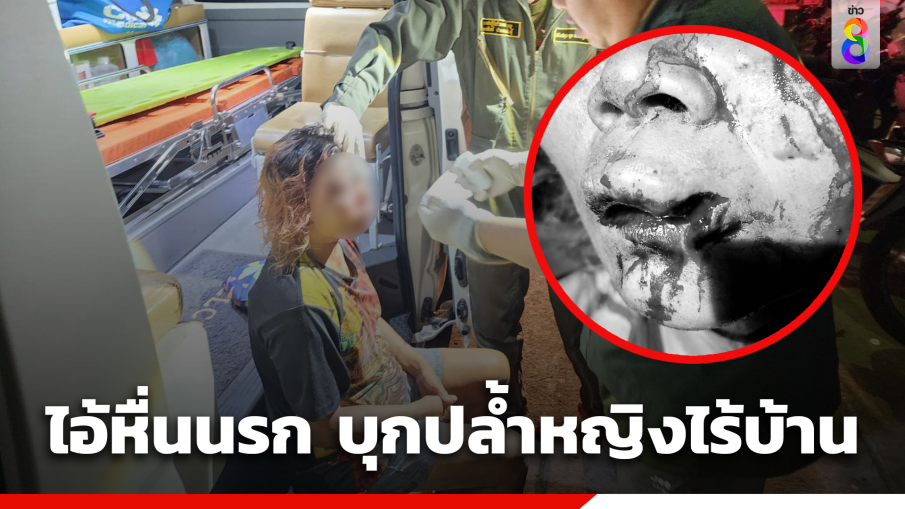 อุกอาจ ! หญิงไร้บ้านถูกชายเร่ร่อนบุกปล้ำขัดขืนซ้อมยับบาดเจ็บสาหัส