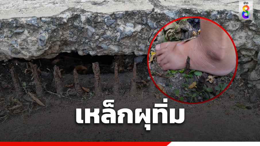 สาวเคราะห์ร้าย เหล็กปากท่อระบายน้ำผุ แทงทะลุเท้า