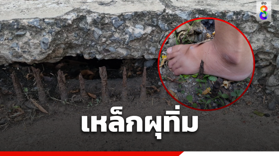 สาวเคราะห์ร้าย เหล็กปากท่อระบายน้ำผุ แทงทะลุเท้า