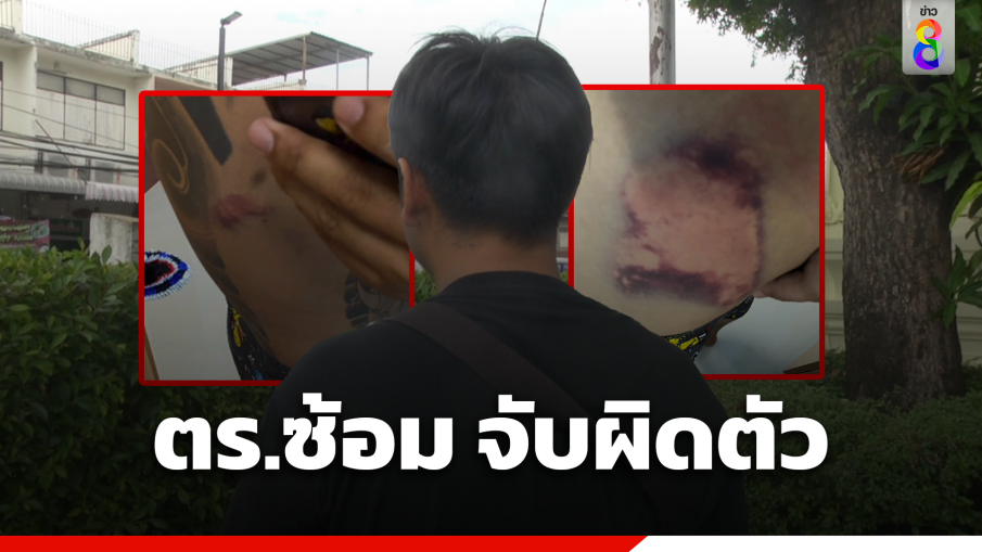 หนุ่มร้อง ตร.รุมซ้อม ใช้นกต่อนัดไปห้อง จับยาผิดตัว 