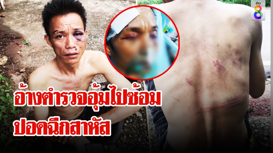 พ่อค้าไก่ตามหาเมียถูกจับ อ้างตร.ซ้อมปอดฉีก-ทรัพย์หาย