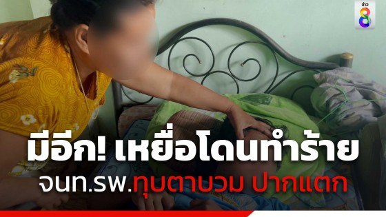 มีอีก! เหยื่อเจ้าหน้าที่โรงพยาบาลโหด แฉพฤติกรรม กำปั้นทุบเบ้าตาบวม...