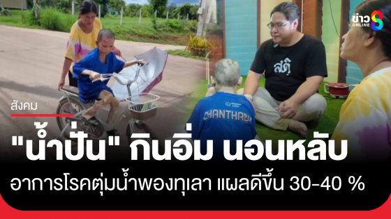 "น้องน้ำปั่น" ยิ้มได้ กินอิ่ม นอนหลับ แผลอาการโรคตุ่มน้ำพองดีขึ้น 30-40 %