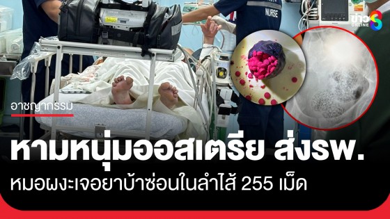 หามหนุ่มออสเตรีย ส่งรพ. หลังปวดท้อง-ชักเกร็ง หมอผงะเจอยาบ้าซ่อนในลำไส้ 255 เม็ด