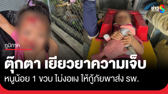 ตุ๊กตาเยียวยาความเจ็บปวด หนูน้อยประสบอุบัติเหตุ