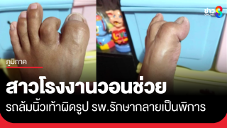 สาวโรงงานวอนช่วย รถล้มนิ้วเท้าผิดรูป รพ.รักษา...