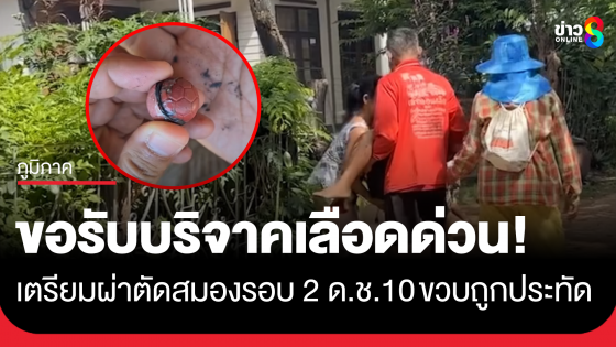 ด.ช. 10 ขวบ ถูกประทัดระเบิด แพทย์ขอรับบริจาคเลือดด่วน เตรียมผ่าตัดสมองรอบ 2