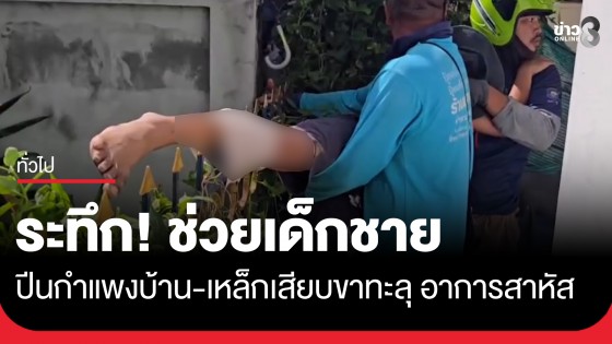ระทึก! ช่วยเด็กชายวัย 12 ปี ปีนกำแพงเล่นซ่อนแอบ พลาดเหล็กเสียบขาทะลุ อาการสาหัส