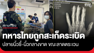 ทหารไทยลาดตระเวนผาหินตัด ถูกสะเก็ดระเบิดนิ้วขาด...