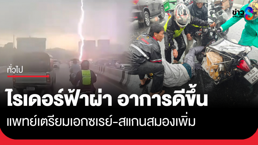 ไรเดอร์ฟ้าผ่า อาการดีขึ้น เตรียมเอกซเรย์-สแกนสมองเพิ่ม
