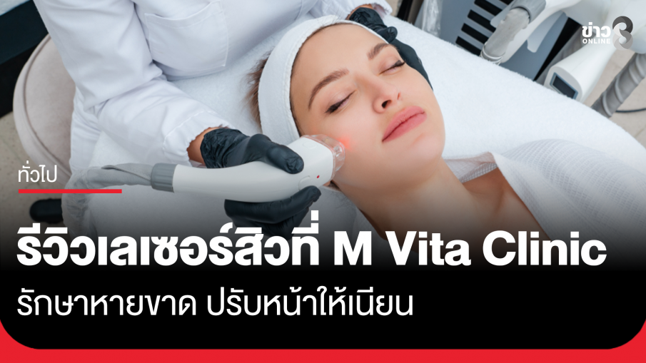 รีวิวเลเซอร์สิวที่ M Vita Clinic รักษาหายขาด ปรับหน้าให้เนียน