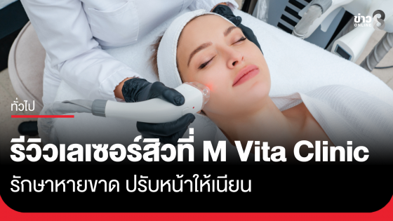 รีวิวเลเซอร์สิวที่ M Vita Clinic รักษาหายขาด ปรับหน้าให้เนียน