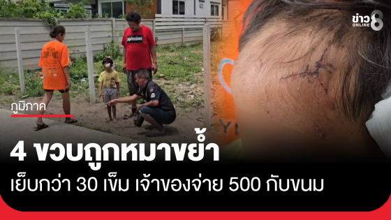 4 ขวบถูกหมาขย้ำ เย็บกว่า 30 เข็ม เจ้าของจ่าย 500 กับขนม
